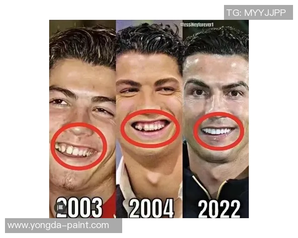 足球明星佩戴牙套的时尚潮流与健康理念探讨 足球明星佩戴牙套的时尚潮流与健康理念探讨